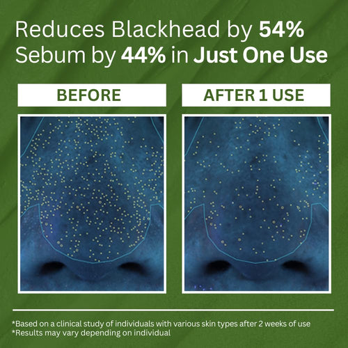 Holy Basil Bubble Deep Mask