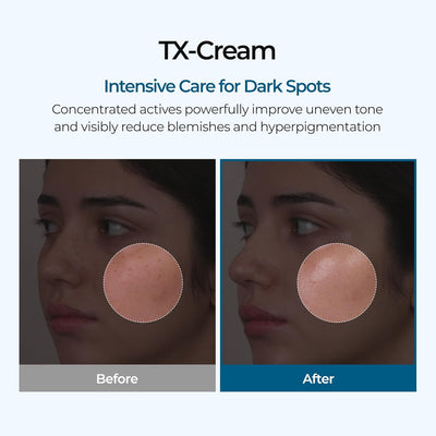 Tranexamic Acid Cream - Dark Spots & Hyperpigmentation